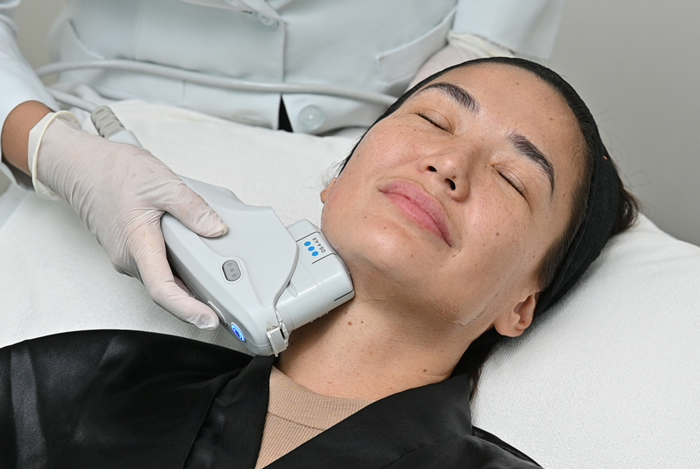 Cadness receives Ultherapy® and Easy Adapt® filler procedures for jawline slimming