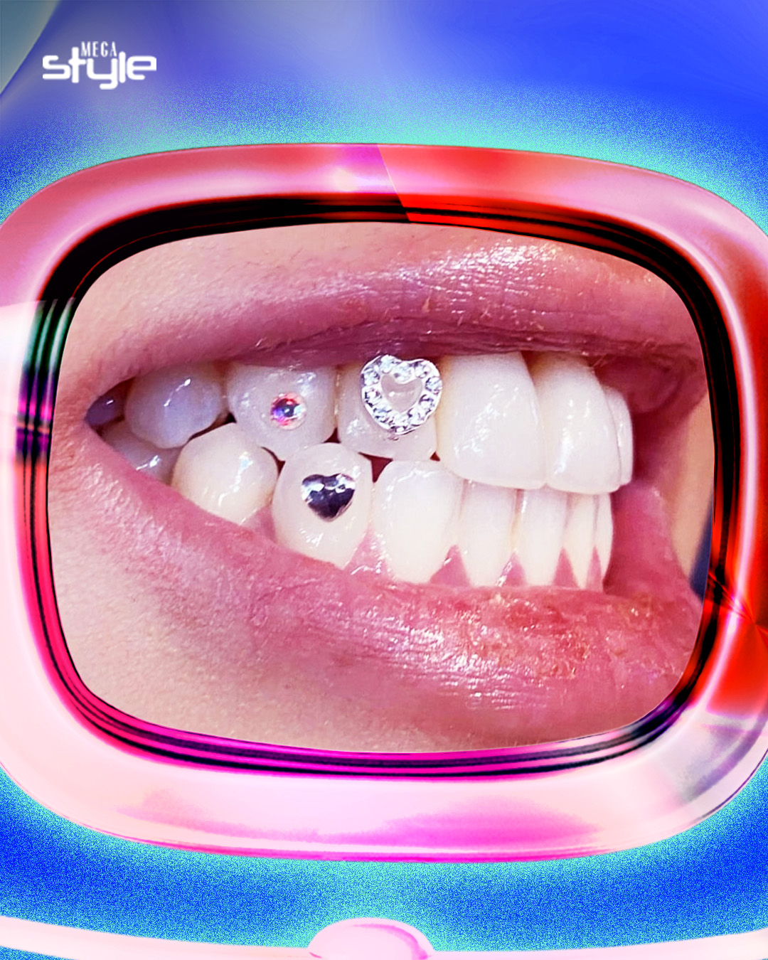 cosmetic tooth design Philippines House of Icy