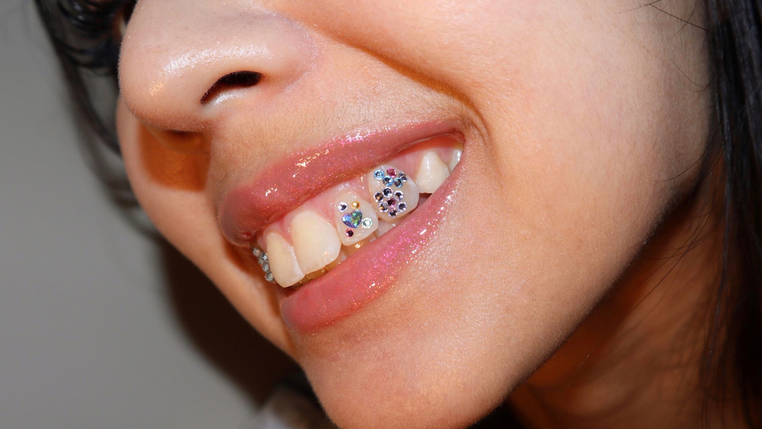 Tooth gems