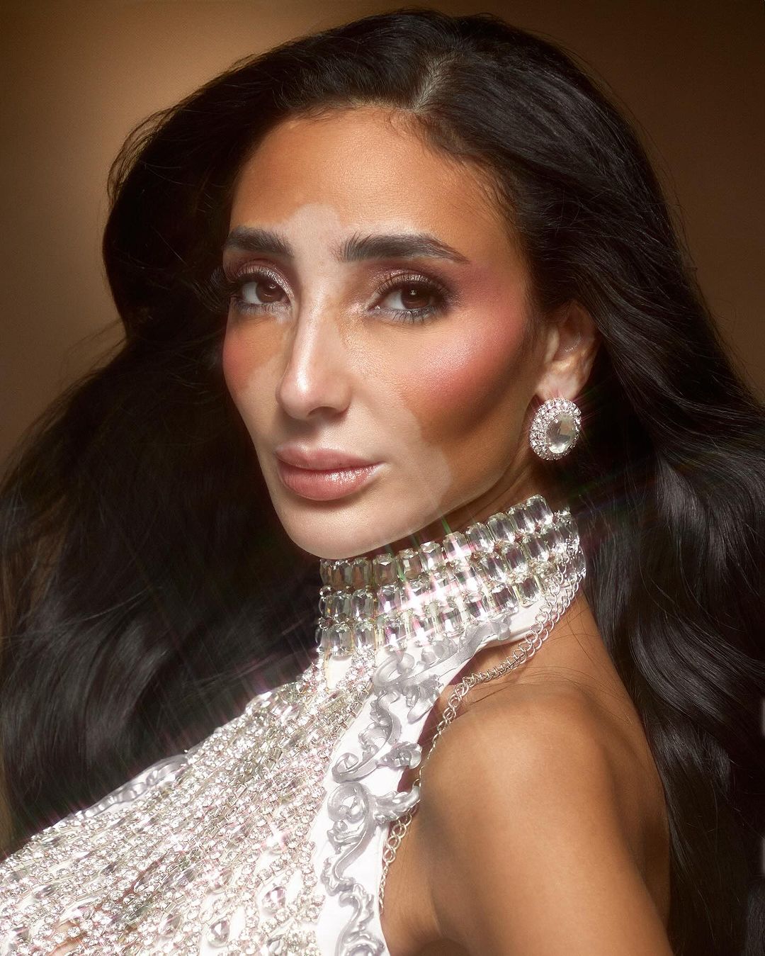 Miss Universe Egypt Logina Salah, a mother diagnosed with vitiligo. Unconventional Queens